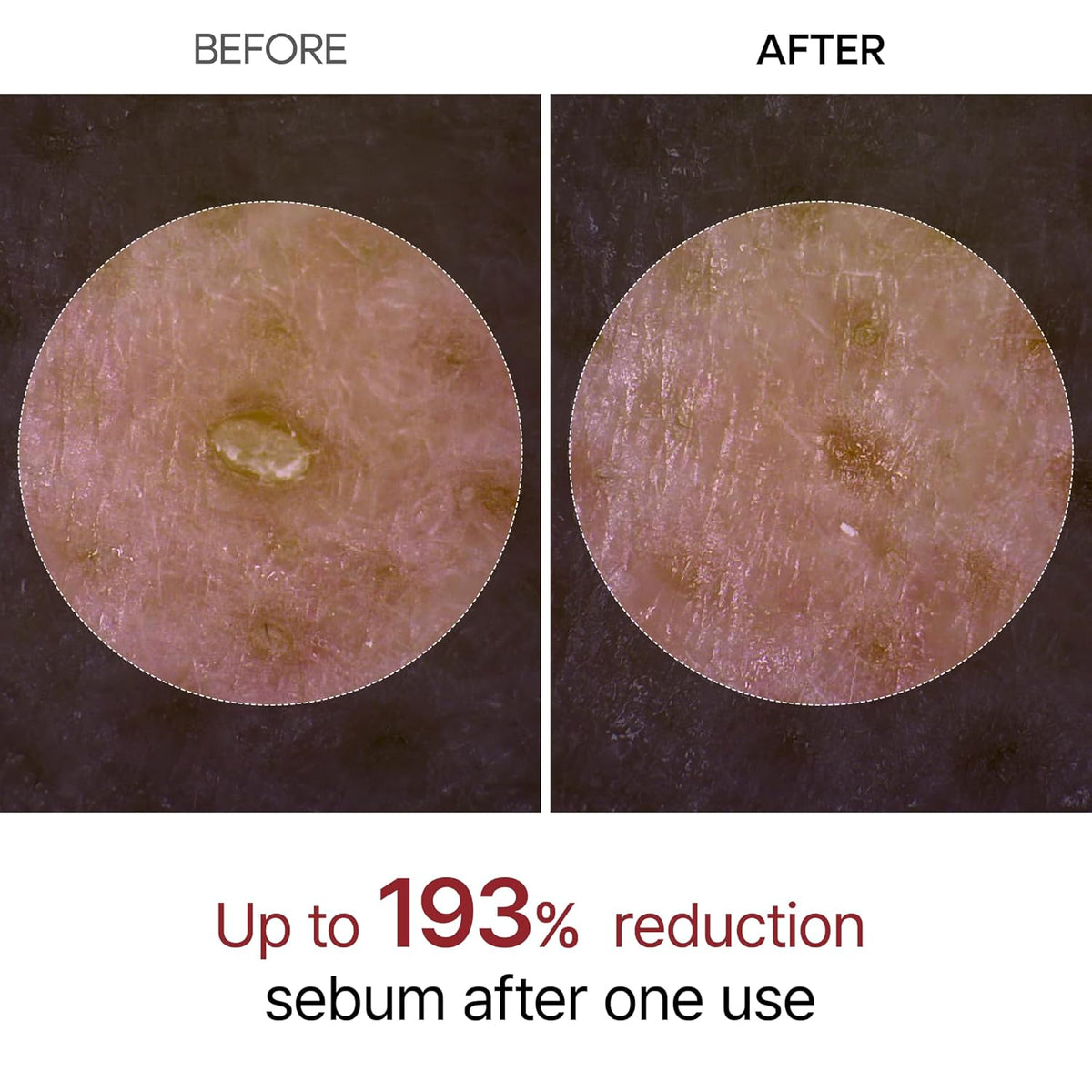 Glass Skin In One Shot β The Korean Secret To Poreless, Radiant Skin Without Irritation. πΎβ¨