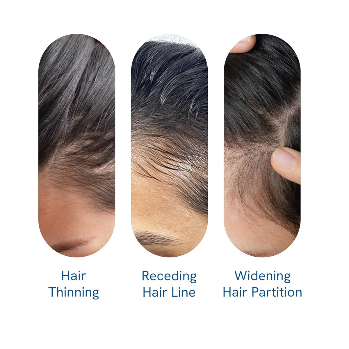 Bodywise Advanced | Science-Backed & Clinically Proven Follicle Activation