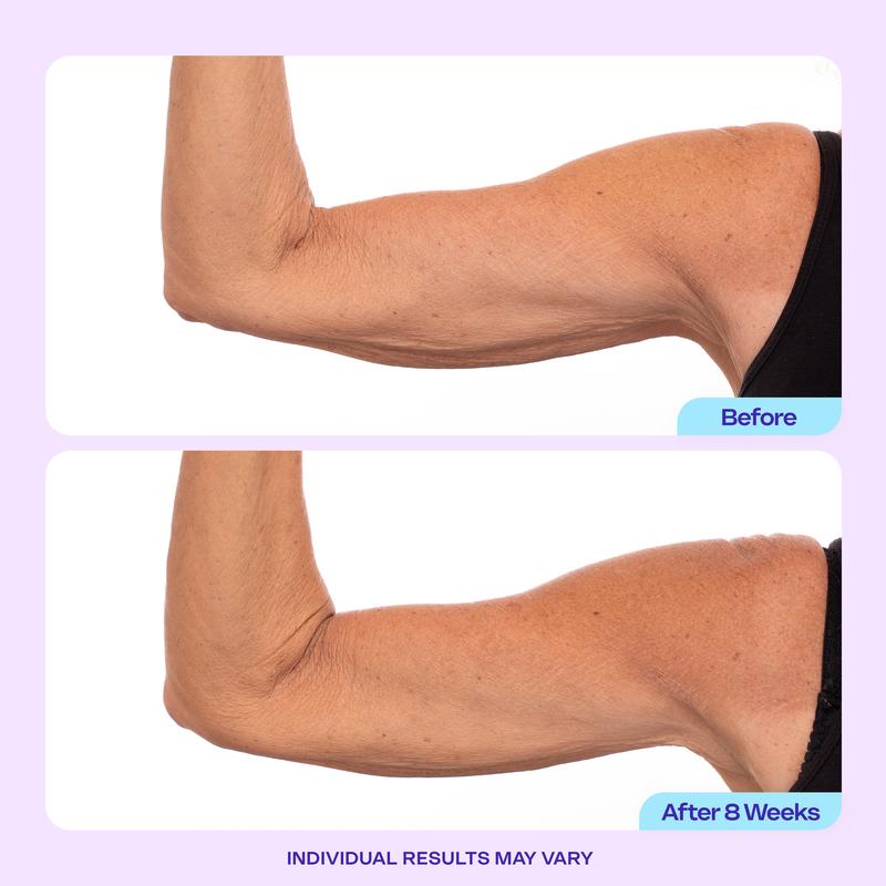 Tighten and Smooth Your Belly Skin With Target Firming Technology