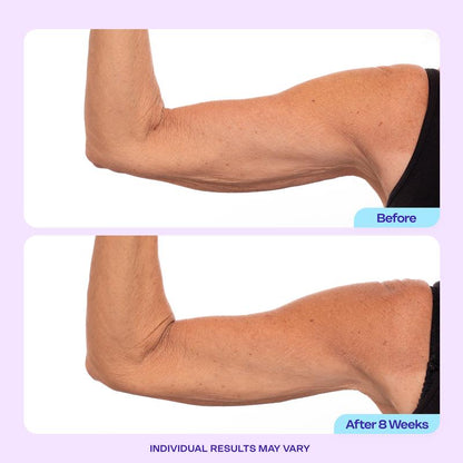 Tighten and Smooth Your Belly Skin With Target Firming Technology