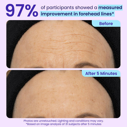 Visibly Tighten & Lift Eye Bags in Just 3 Minutes