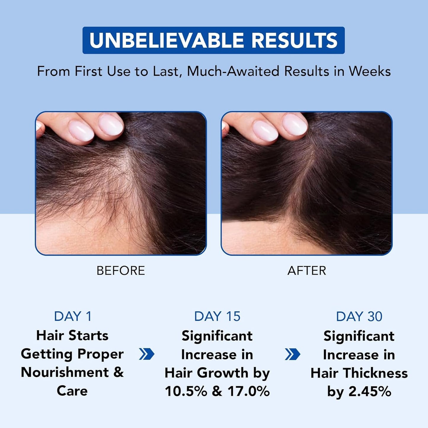 Thicker, Fuller, Stronger — The Viral Rosemary Mint Ritual for Your Hair - Buy 1 Get 1 Free