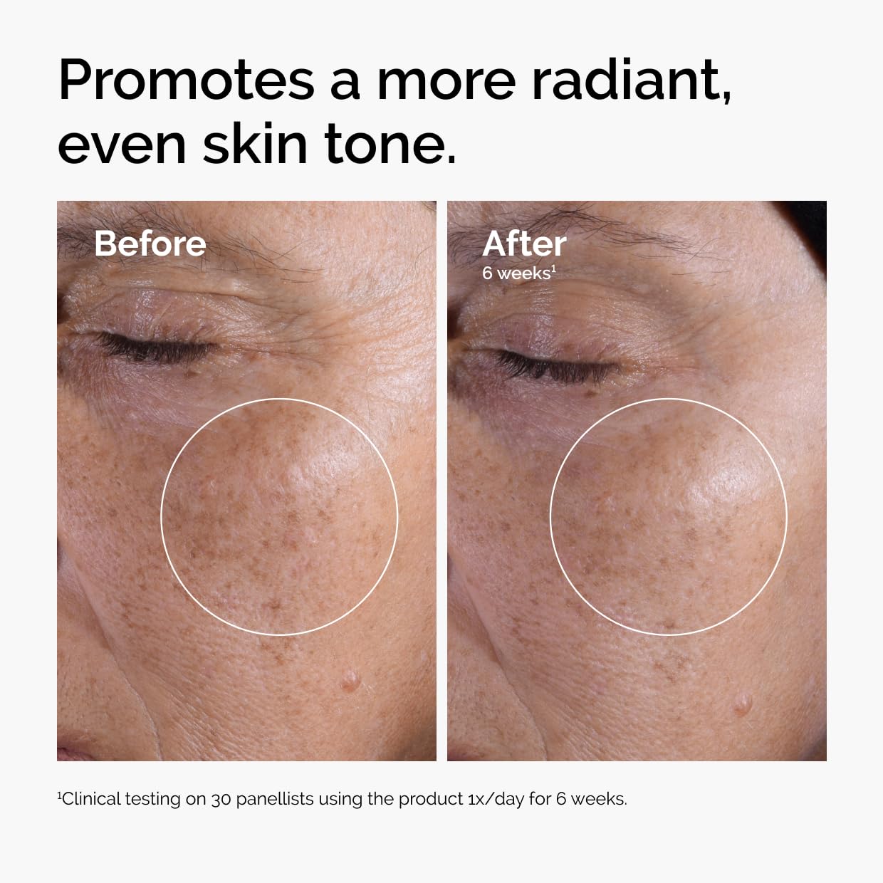 Glow Beyond Smooth: The Ultimate 7% AHA Skin Resurfacer
