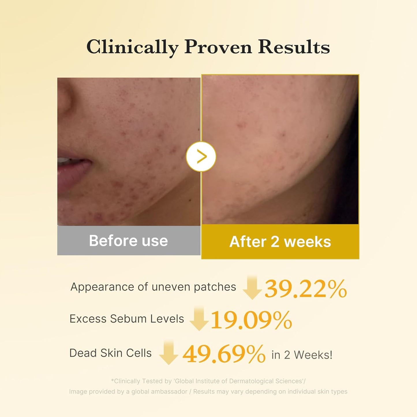 Fade the Dark, Reveal the Bright: Science-Driven Skin Correction.