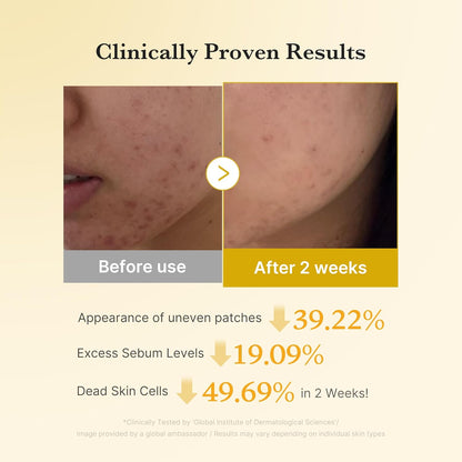 Fade the Dark, Reveal the Bright: Science-Driven Skin Correction.