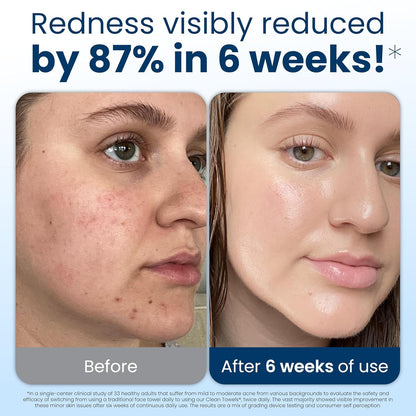 XL Bio-Based Disposable Face Towels for Sensitive Skin