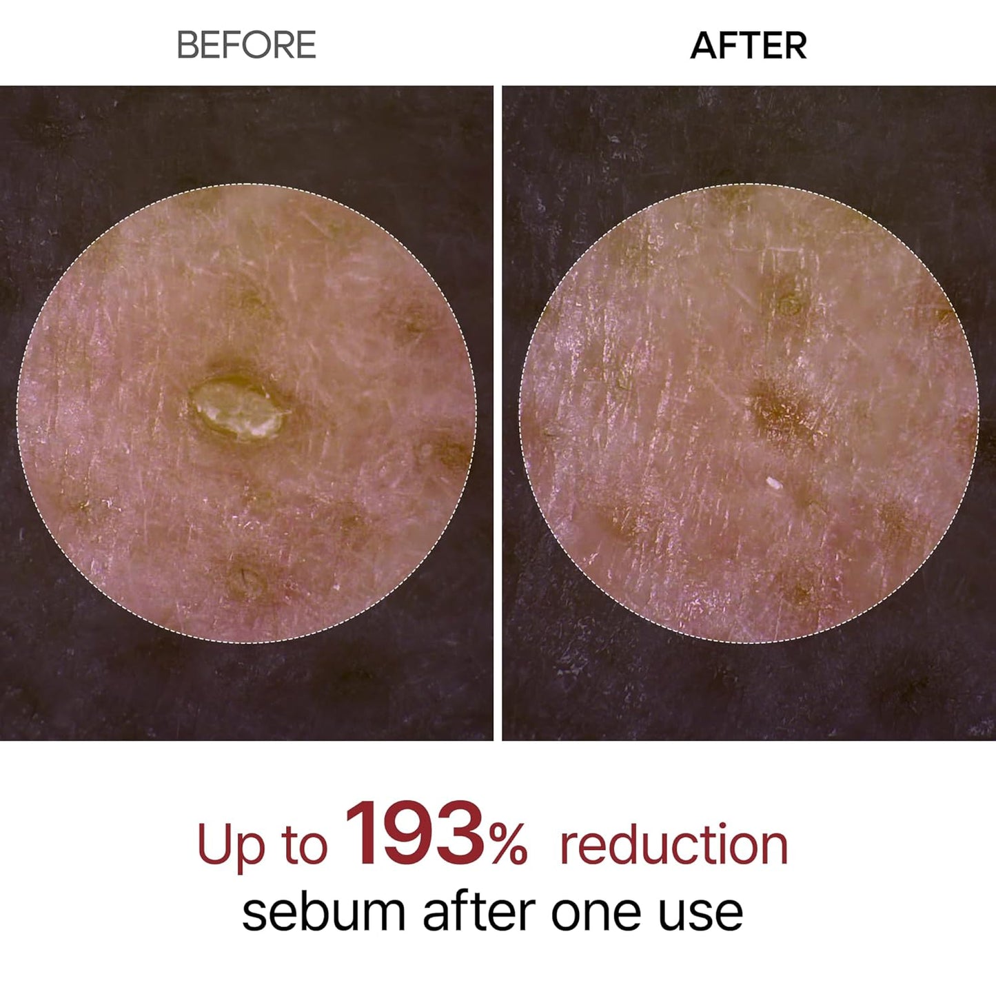 Glass Skin In One Shot — The Korean Secret To Poreless, Radiant Skin Without Irritation. 🌾✨