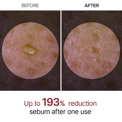 Glass Skin In One Shot — The Korean Secret To Poreless, Radiant Skin Without Irritation. 🌾✨