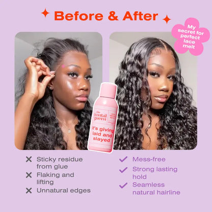 Say Goodbye To Ashy Lace — The Secret To A Seamless, "Melted" Scalp Look