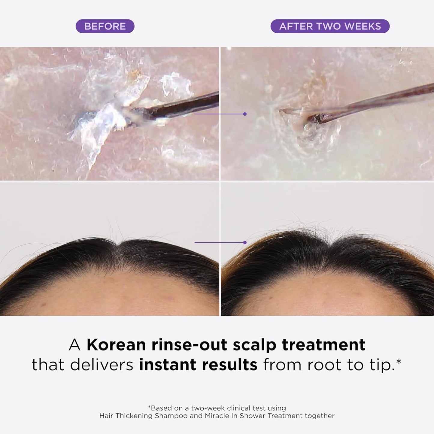 Clinical Hair Rebirth: Stop Thinning & Regrow Thicker Hair in 4 Weeks