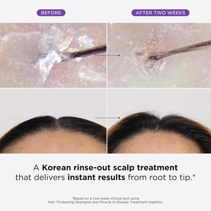 Clinical Hair Rebirth: Stop Thinning & Regrow Thicker Hair in 4 Weeks