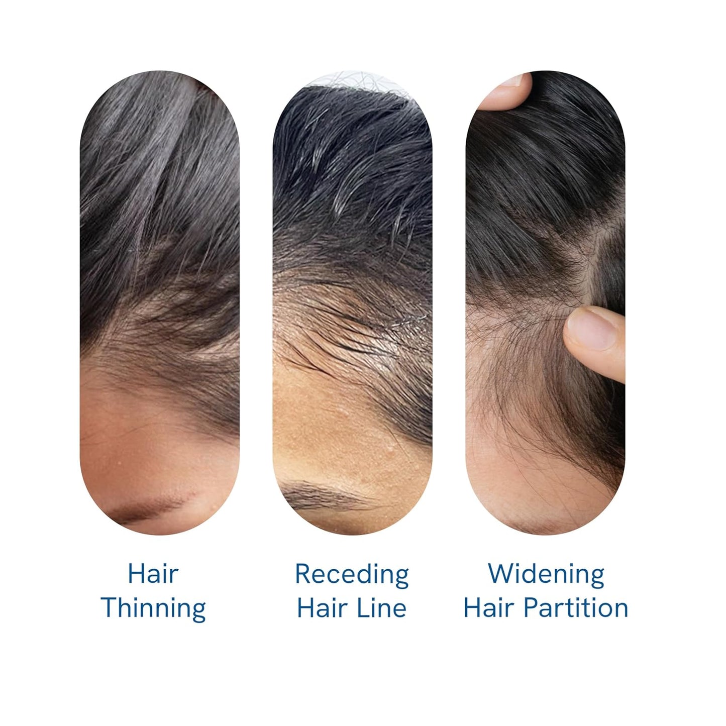 Bodywise Advanced | Science-Backed & Clinically Proven Follicle Activation