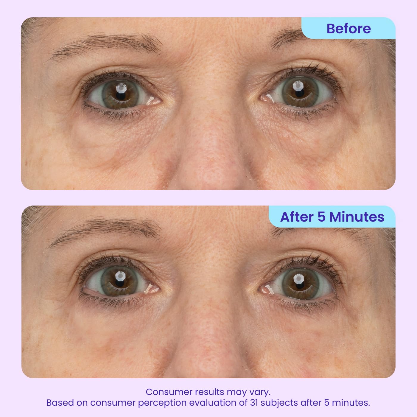 Visibly Tighten & Lift Eye Bags in Just 3 Minutes
