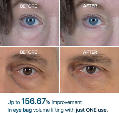 Erase Eye Bags. Smooth Like Asphalt