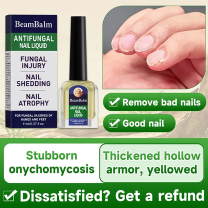 Extra Strength Nail Repair Solution – Restore Clear, Healthy Nails Fast