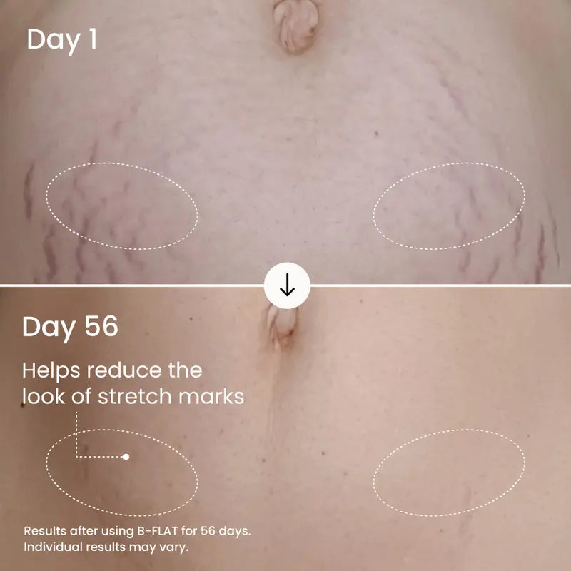 Visibly Firm and Smooth Your Belly With Clinically Proven Firming Cream