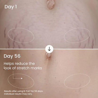 Visibly Firm and Smooth Your Belly With Clinically Proven Firming Cream