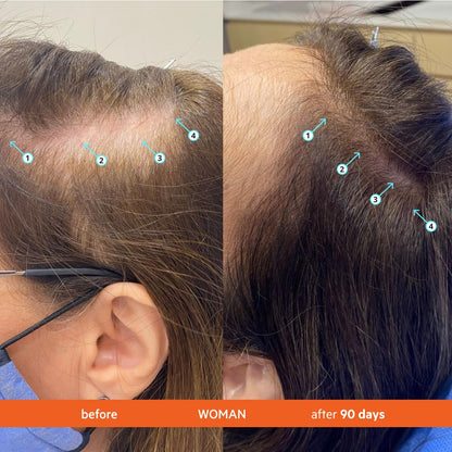 Science-Backed Hair Revival. Dermatologist-Recommended