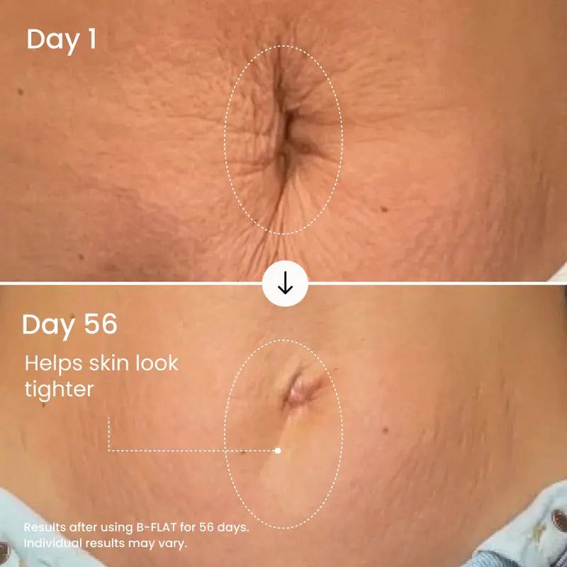 Visibly Firm and Smooth Your Belly With Clinically Proven Firming Cream