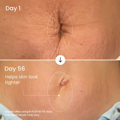 Visibly Firm and Smooth Your Belly With Clinically Proven Firming Cream