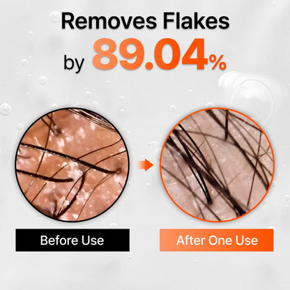 Grow Thicker, Fuller Hair. Stroke by Stroke