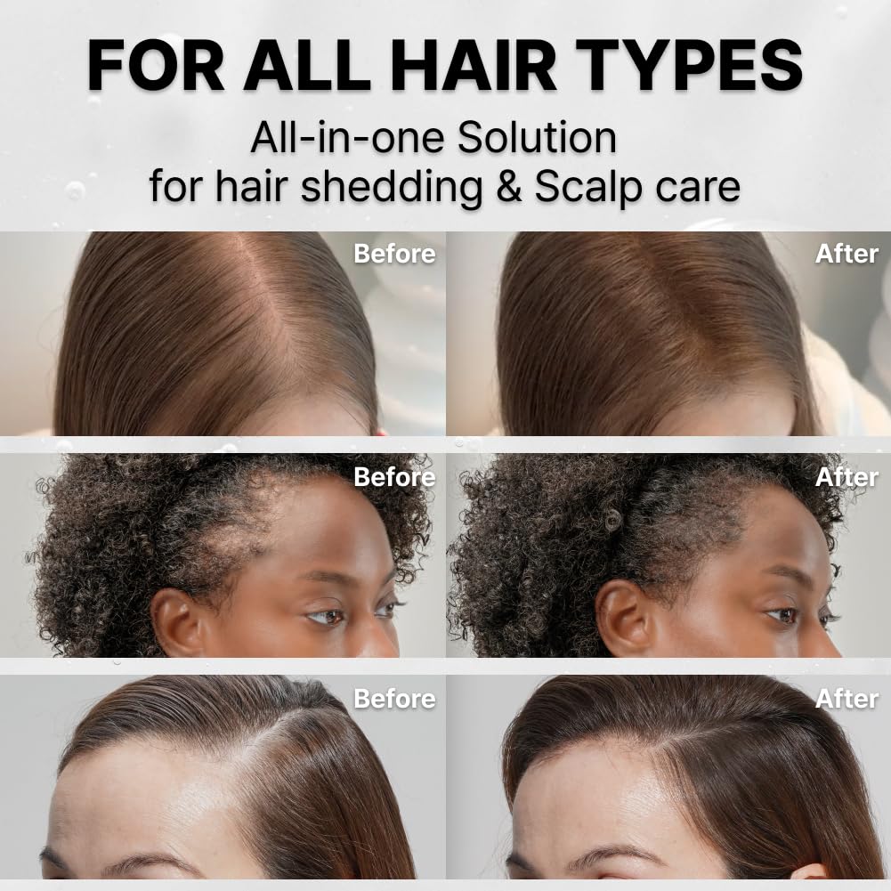 Grow Thicker, Fuller Hair. Stroke by Stroke