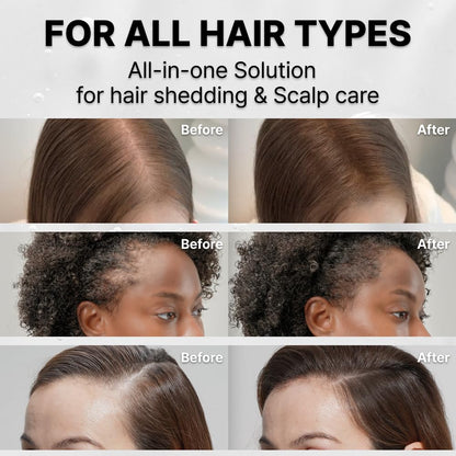Grow Thicker, Fuller Hair. Stroke by Stroke