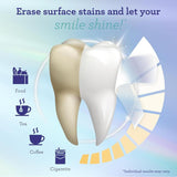 White Teeth in 7 Days: Confidently Smile Again.