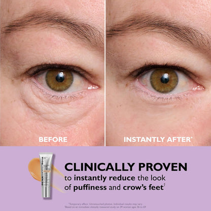 Erase Eye Bags In 3 Minutes — The Viral Instant Eye Lift That Actually Works