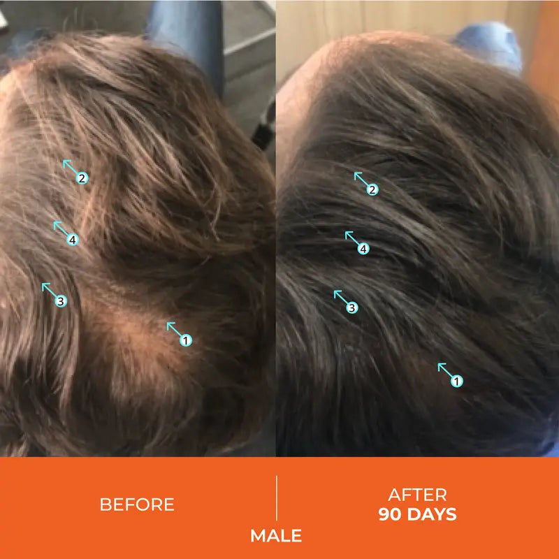 Science-Backed Hair Revival. Dermatologist-Recommended