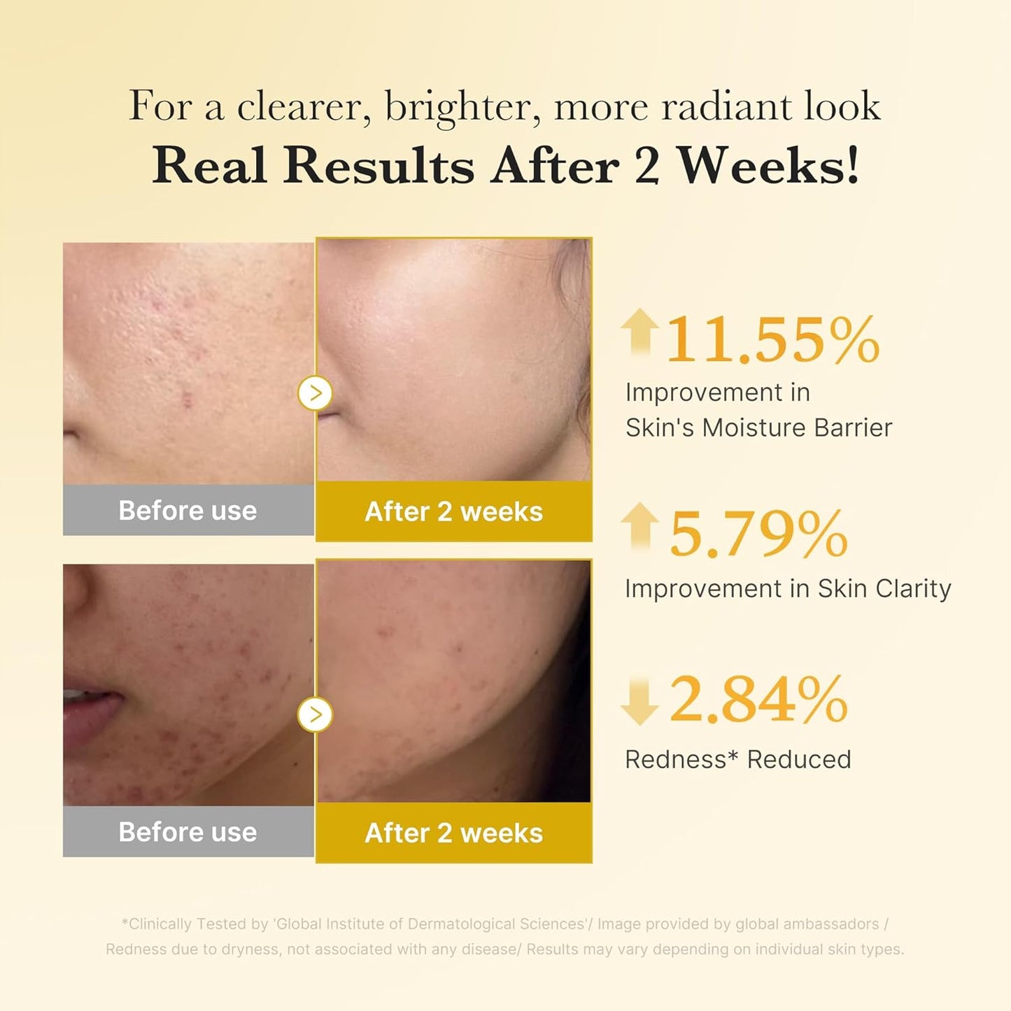 Fade the Dark, Reveal the Bright: Science-Driven Skin Correction.