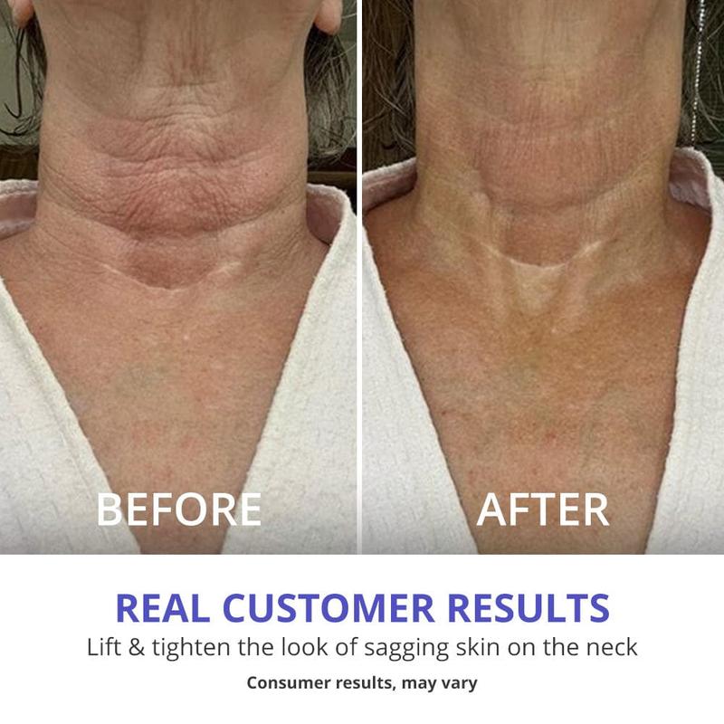 Tighten and Smooth Your Belly Skin With Target Firming Technology