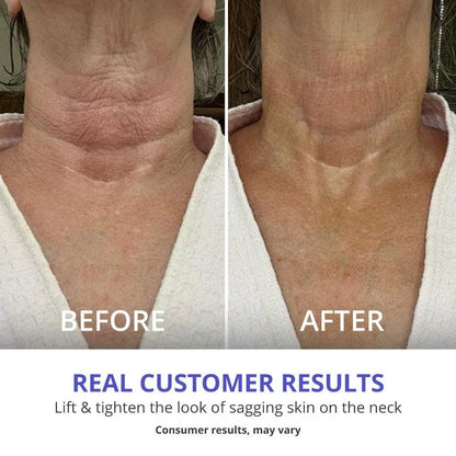 Tighten and Smooth Your Belly Skin With Target Firming Technology