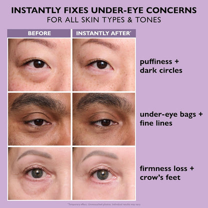 Erase Eye Bags In 3 Minutes — The Viral Instant Eye Lift That Actually Works