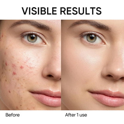 Poreless in Seconds: Alaska Volcano Deep Cleansing Stick
