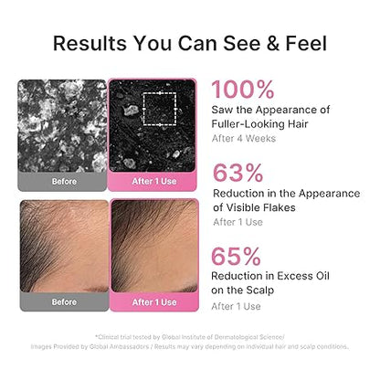 Advanced Rosemary PDRN Hair Recovery & Strengthening System