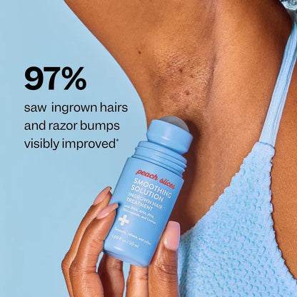 Smooth In-Grown Hair & Razor Bumps Instantly With Roller Precision
