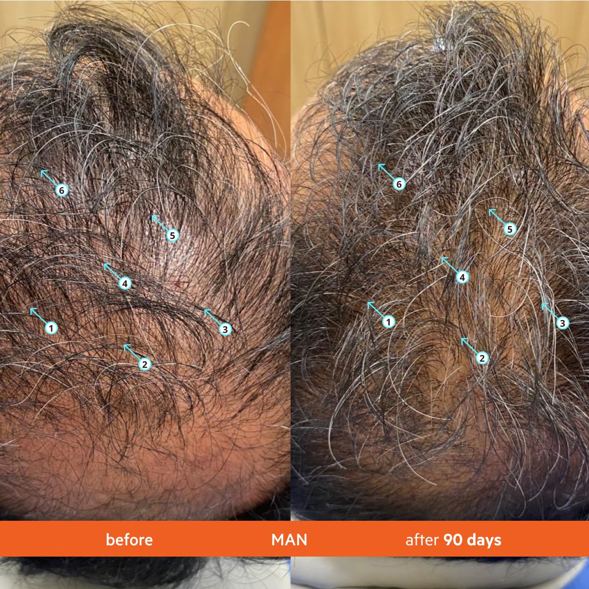 Advanced Hair Density & Growth Stimulating Shampoo