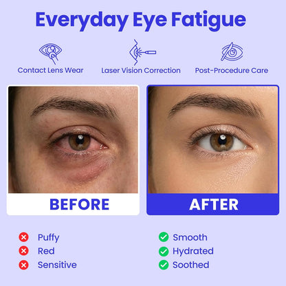 Self-Heating Steam Eye Mask for Instant Relief & Deep Relaxation