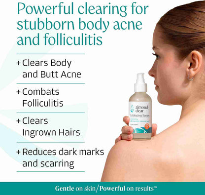 Clear Body Acne & Folliculitis with 15% Mandelic Acid Exfoliating Serum | Buy 1 Get 1 Free