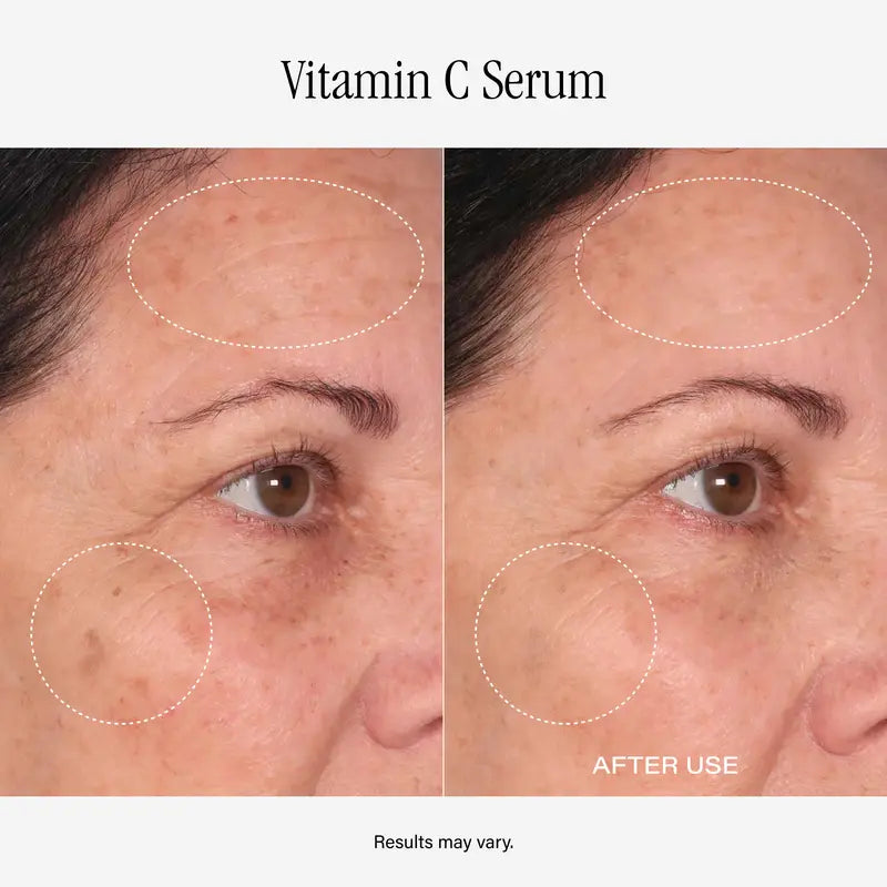 SKINN Divine Elixir Vitamin C Serums – Two-Bottle Set original product photo