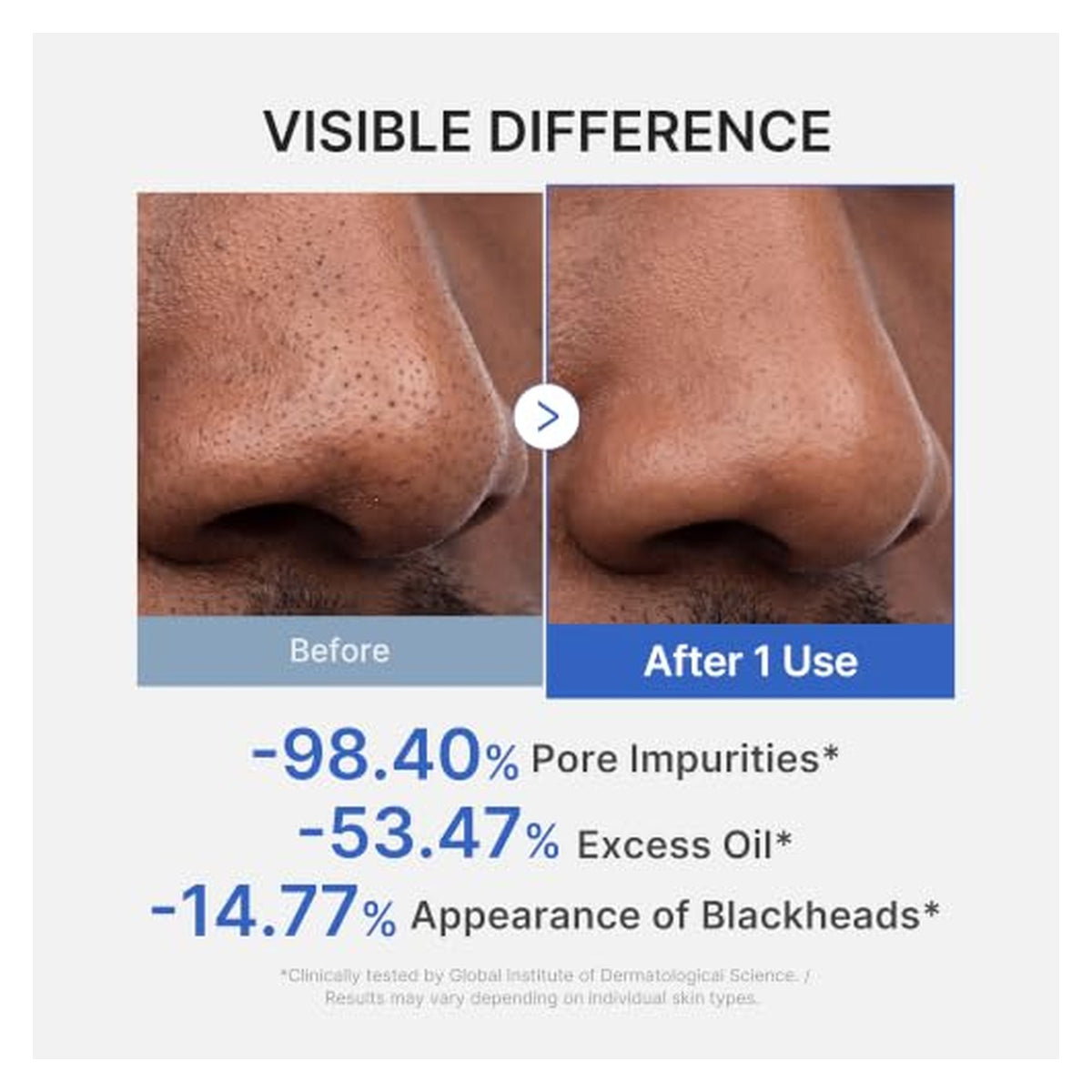 Before-and-after comparison of a nose showing visible pore reduction after one use. Labeled 'Visible Difference' with stats: -98.40% pore impurities, -53.47% excess oil, -14.77% appearance of blackheads. Clinically tested.