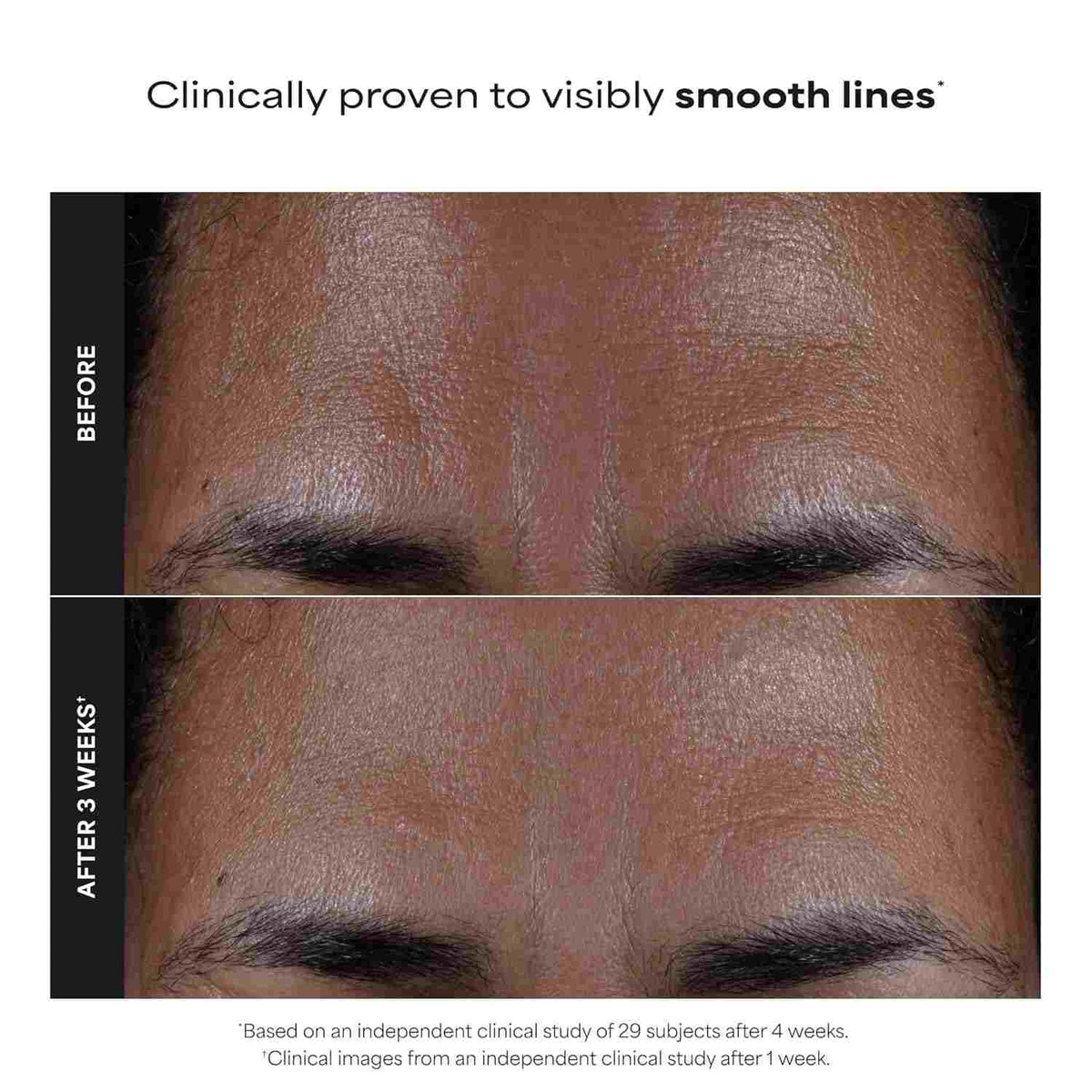 2% BHA Liquid Exfoliator – Unclog Pores & Smooth Skin Texture