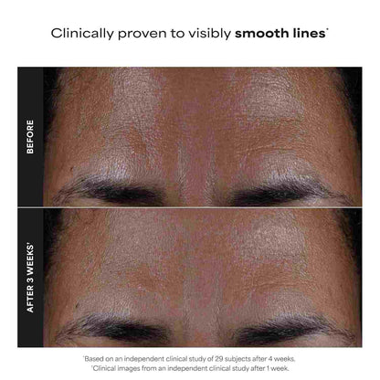 2% BHA Liquid Exfoliator – Unclog Pores & Smooth Skin Texture